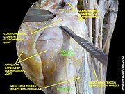 Head of humerus