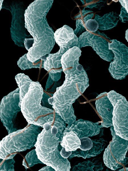 File:ARS Campylobacter jejuni.jpg