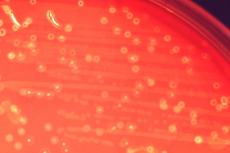 File:Streptococcus anginosus.tif