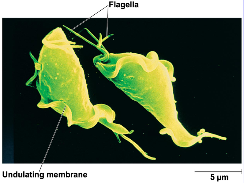 File:Trichomonas vaginalis (20).png