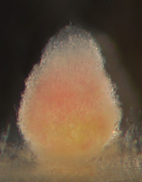 File:Indeterminate Nodule Zonation.JPG