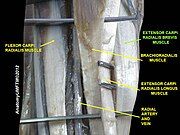 Extensor carpi radialis brevis muscle