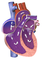 Blood flow in a neonate