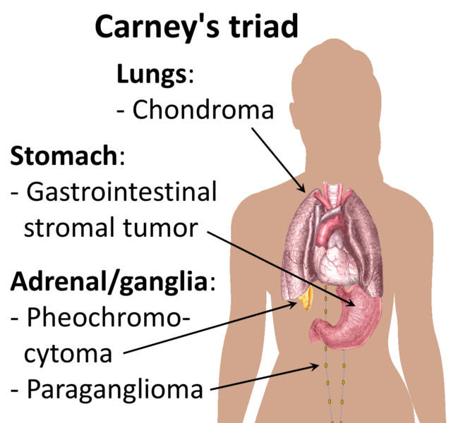 File:Carney's triad.png