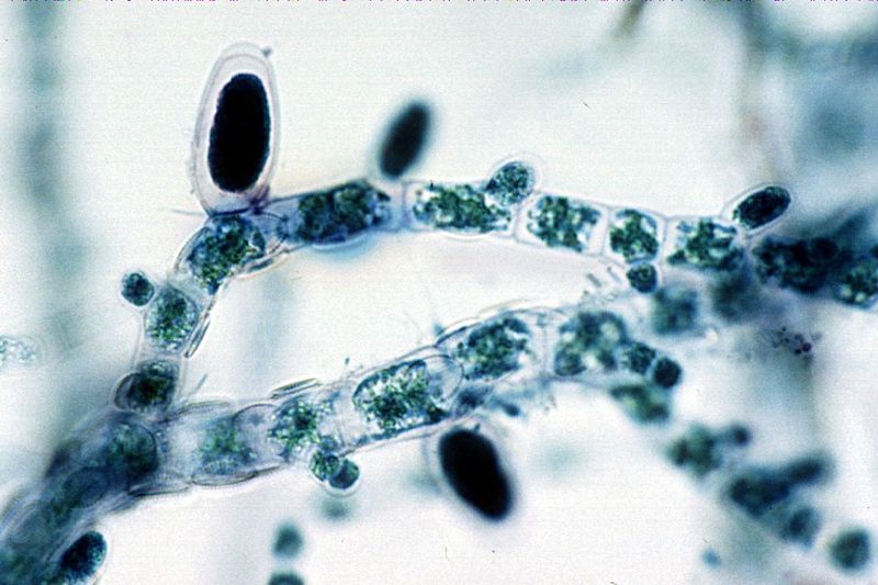 File:Ectocarpus unilocular structure.jpg