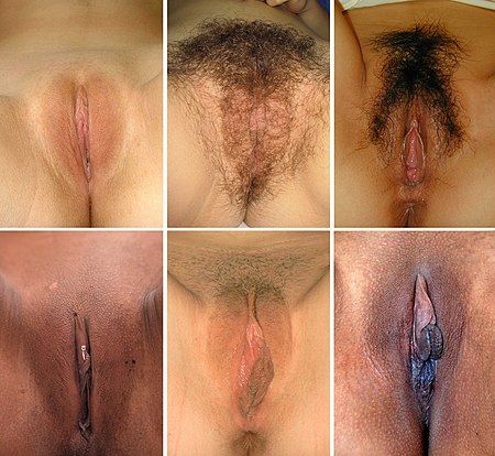 Montage showing vulva diversity