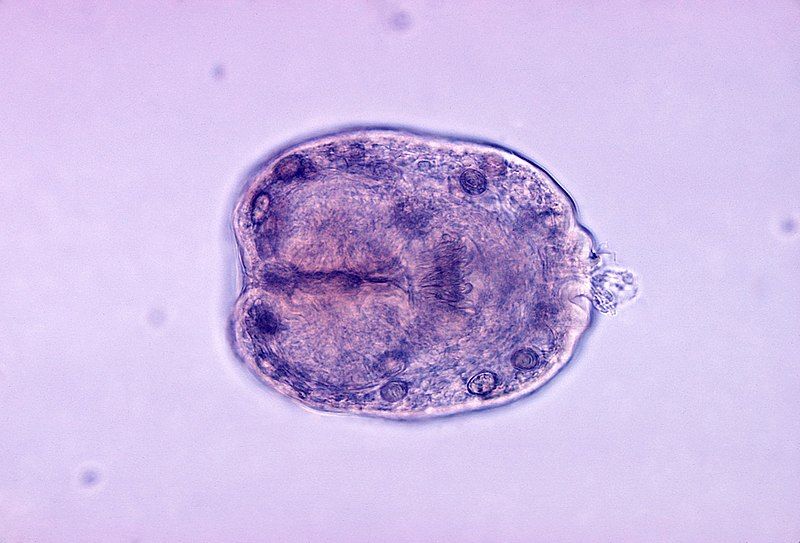 File:Echinococcus granulosus scolex.jpg