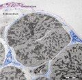 Figure 11. Digitally coloured electron micrograph of mouse ventricular endocardium (burgundy). TC (blue) make an interstitial network in the heart. Subendocardial telocytes (TC1) sends Tp between cardiomyocytes (CM) and communicate with TC2. Cap, blood capillary. Scale bar 5 μm. Reproduced with permission from [4]