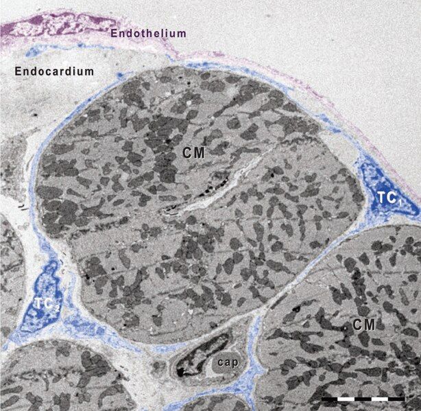 File:Telocytes-Fig 11.tif