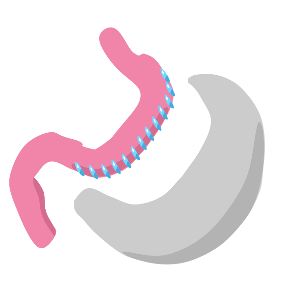 File:Gastric sleeve icon.svg