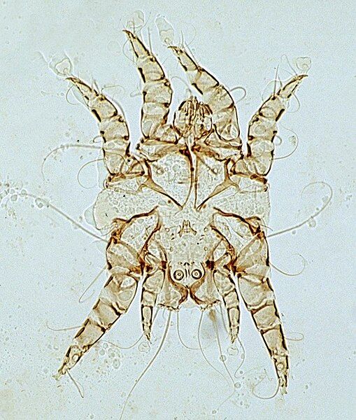 File:Otodectes-mite.jpg