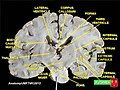 Thalamus coronal section