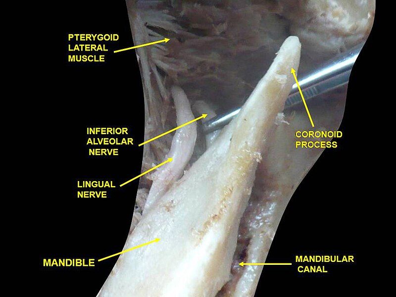 File:Slide2cec.JPG