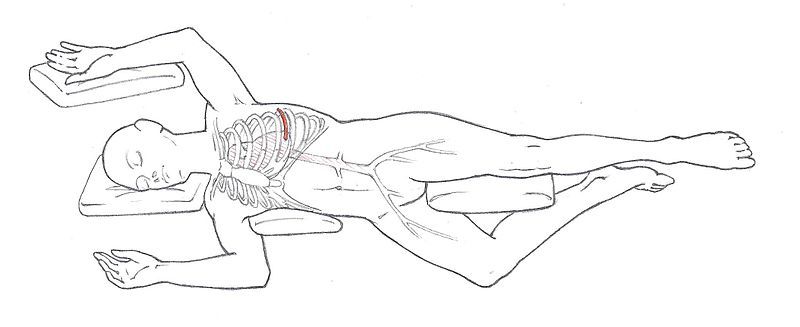 File:Thoracotomy Outline.JPG