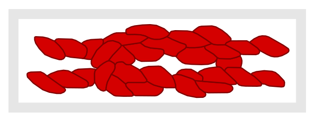 File:BSA Heroism Knot.svg