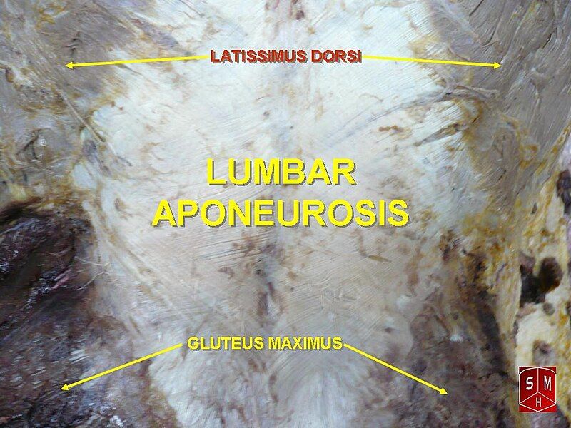 File:Lumbar aponeurosis.jpg