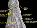 Inferior extensor retinaculum of foot. Deep dissection.