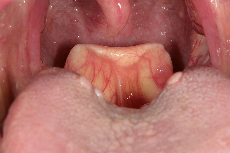 File:High rising epiglottis.JPG