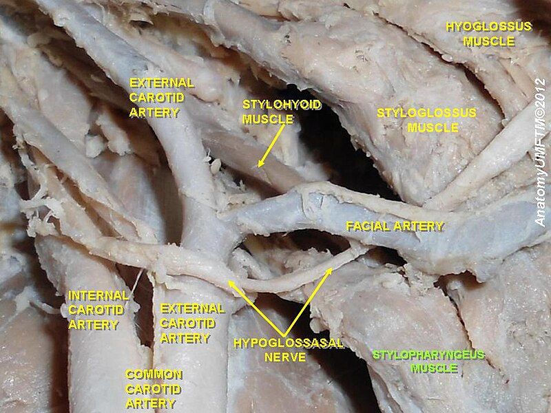 File:Slide9aaa.JPG