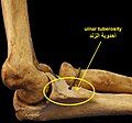 Tuberosity of the ulna.