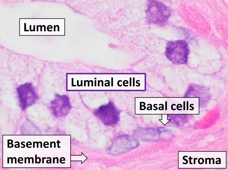 File:Prostate gland microanatomy.png