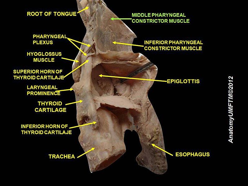 File:Slide12mmm.JPG