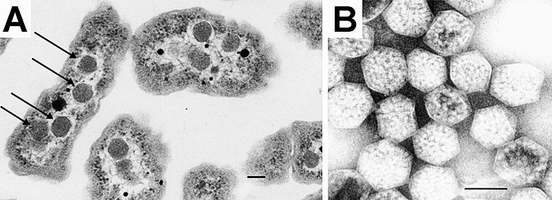 File:Carboxysomes EM.jpg