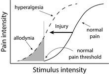 AMPS, pain amplification syndrome, juvenile fibromyalgia, childhood fibromyalgia