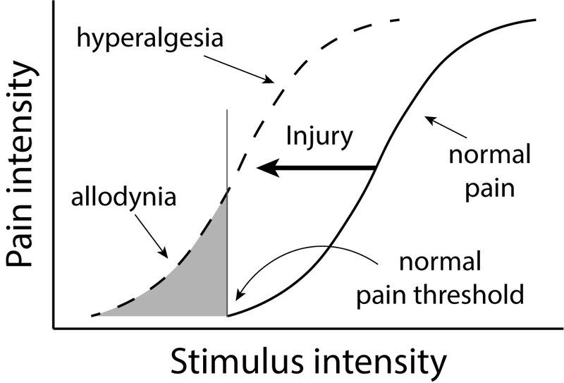 File:Hyperalgesia and allodynia.tif