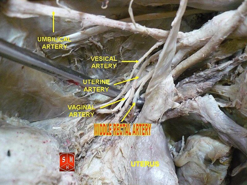 File:Middle rectal artery.jpg