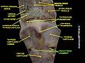 Cricothyroid ligament