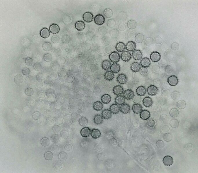 File:Aspergillus parasiticus UAMH5727b.jpg