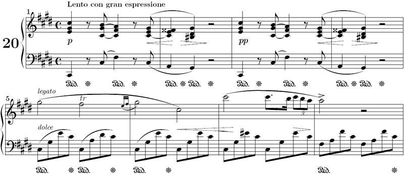 File:Chopin nocturne 20a.png