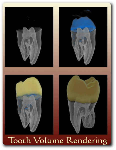 File:Drishti-tooth.png