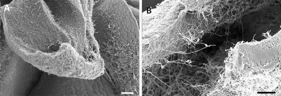 File:Streptomyces mycelial sheets.webp