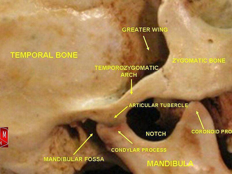 File:Temporomandibular joint.jpg