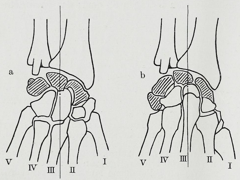 File:Braus 1921 213.png