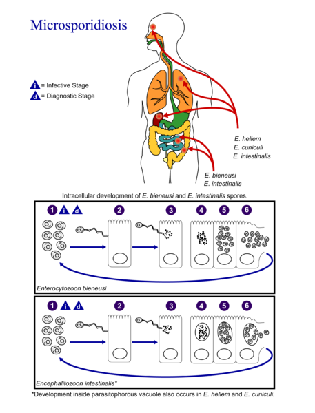 File:Microsporidiosis 01.png