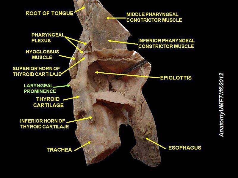 File:Slide5mmm.JPG