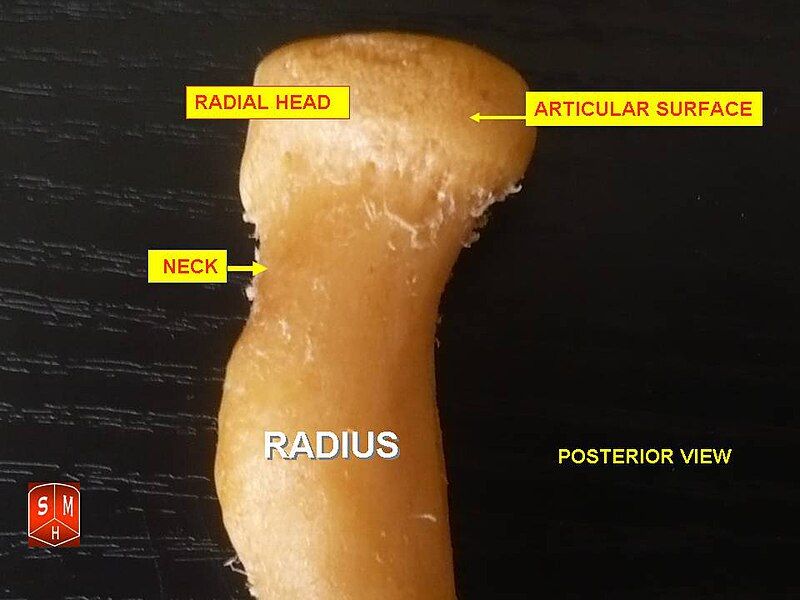 File:Radius2.jpg