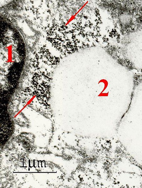 File:Macrophage ferritin.jpg