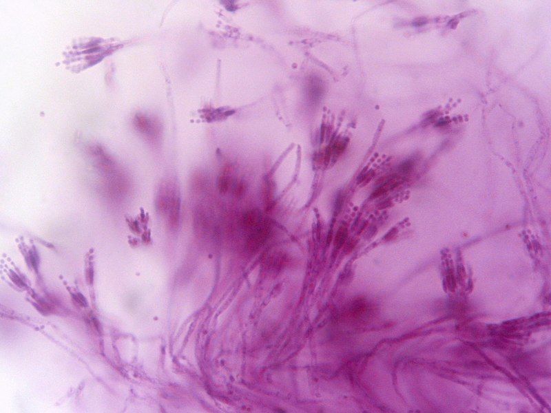 File:Penicillium Pengo.jpg