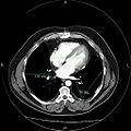 An image taken using a picture archiving and communication system, amended using tools on the system. Patient identity is protected.